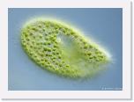 Paramecium bursaria * Een groen pantoffeldiertje (Paramecium bursaria).
 * 640 x 468 * (71KB)